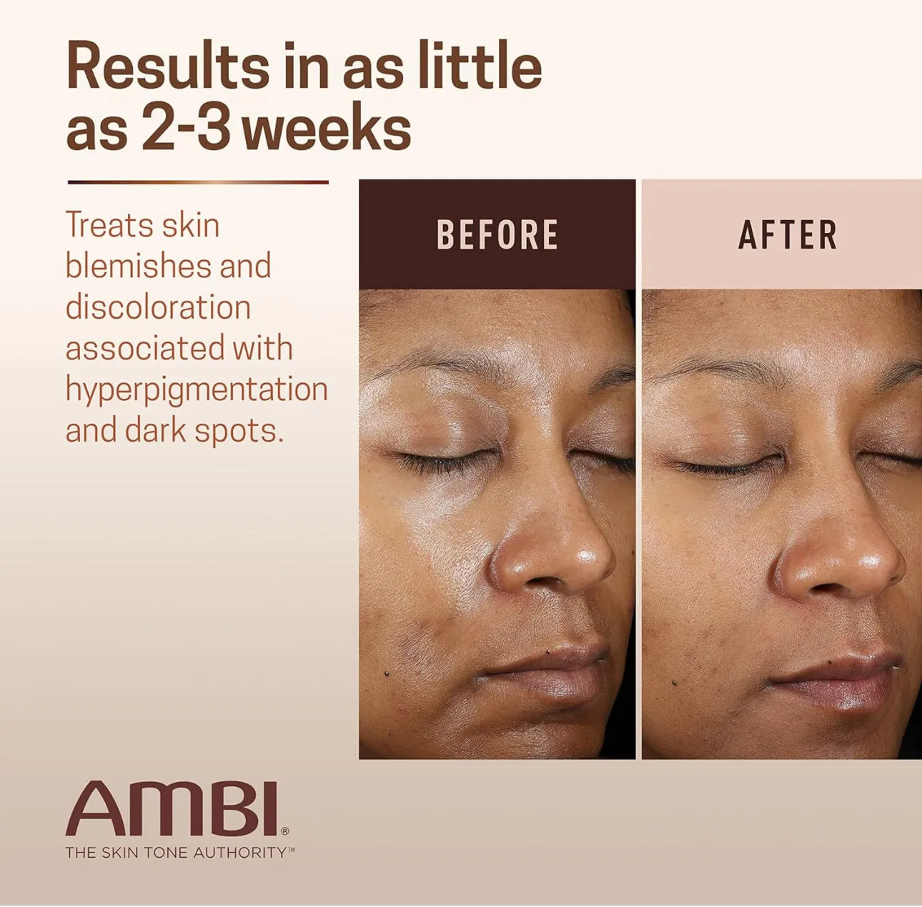 AMBI SKIN CARE FADE CREAM
