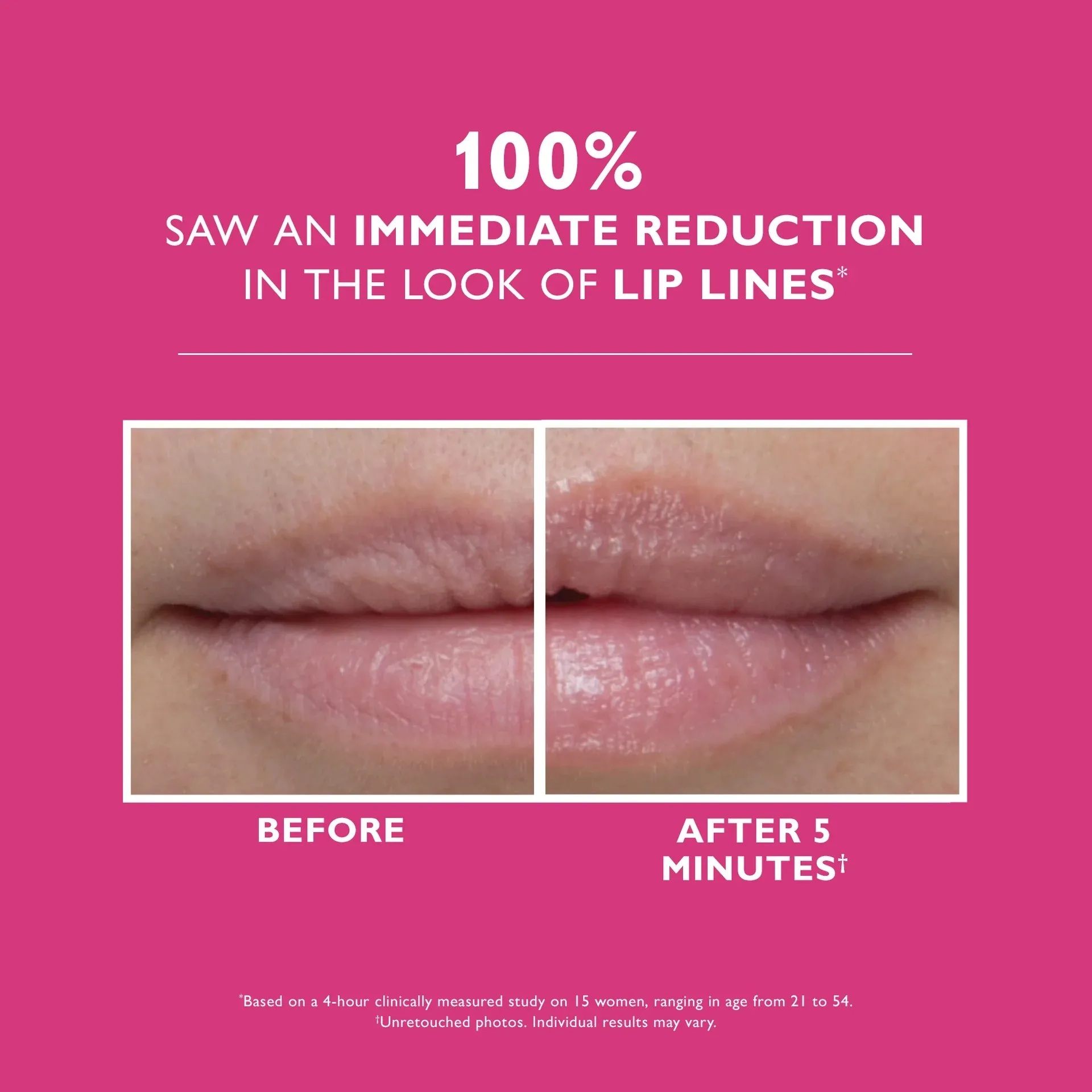 Peter Thomas Roth Instant FIRMx Lip Filler